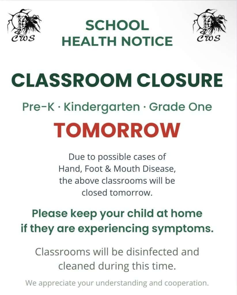 Clifford Wuttunee School health notice: Pre-K, Kindergarten and Grade One classrooms closed October 5 due to possible cases of Hand, Foot and Mouth Disease